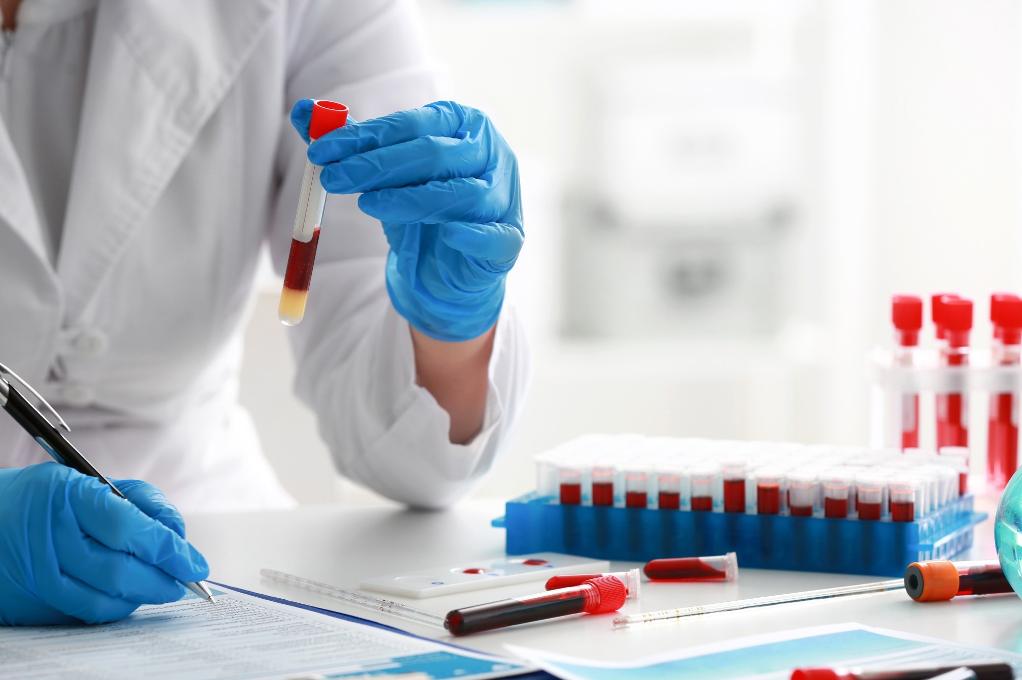 Une étude révèle que les biomarqueurs plasmatiques peuvent prédire le risque de démence