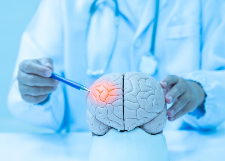 Study: Cognitive function in adolescence and the risk of early-onset stroke. Image Credit: Komsan Loonprom/Shutterstock.com