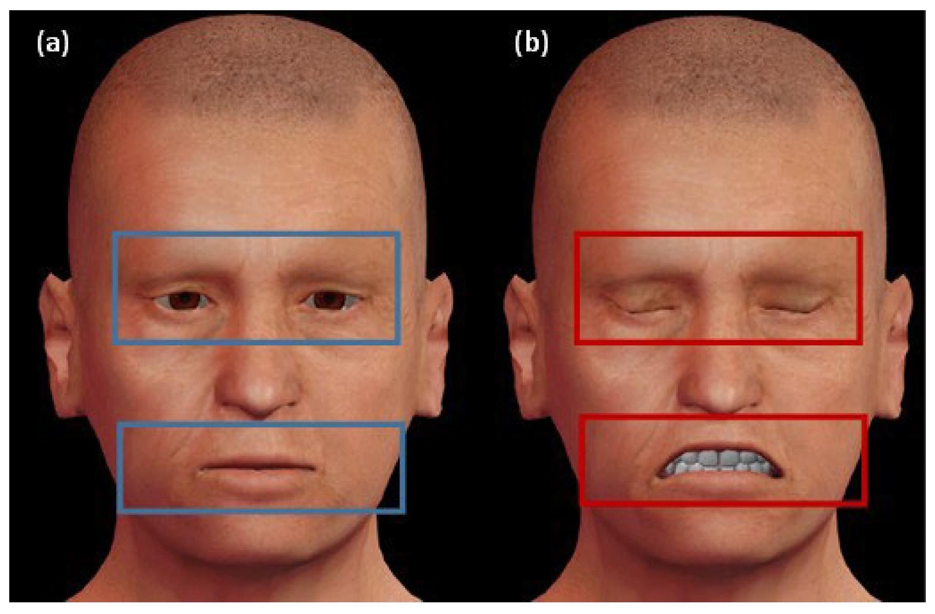 Zones d'expression faciale qui révèlent si le patient est en détérioration ou non. (a) L'avatar de gauche exprime une expression neutre, délimitée par les rectangles bleus. (b) L'avatar de droite révèle l'état de détérioration au stade final, délimité par les rectangles rouges.