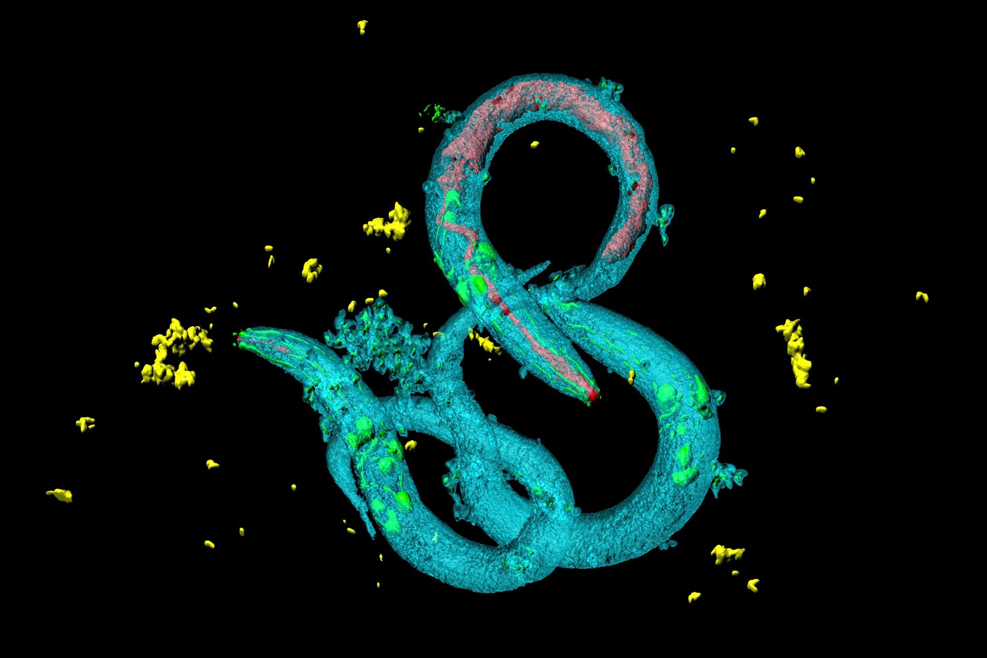 Study: A homeostatic gut-to-brain insulin antagonist restrains neuronally stimulated fat loss. Image Credit: Heiti Paves / Shutterstock.com