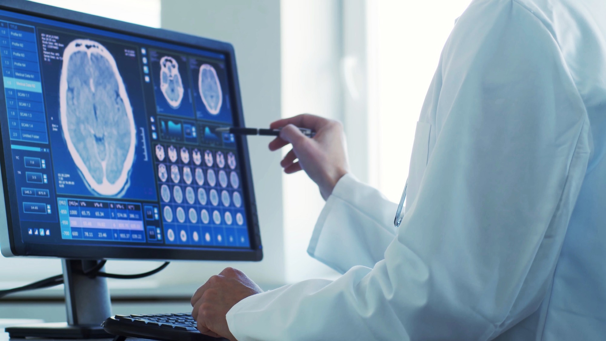 La stimulation cérébrale profonde adaptative pilotée par l'IA améliore les symptômes de la maladie de Parkinson