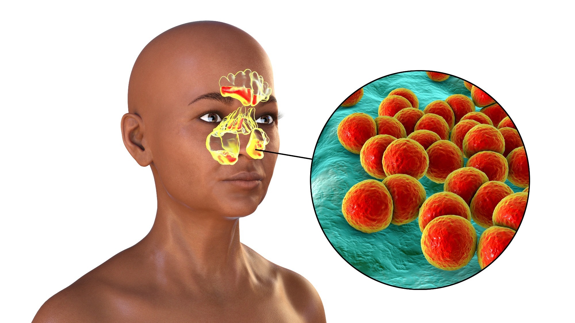 Study: Host and environmental factors shape upper airway microbiota and respiratory health across the human lifespan. Image Credit: Kateryna Kon / Shutterstock