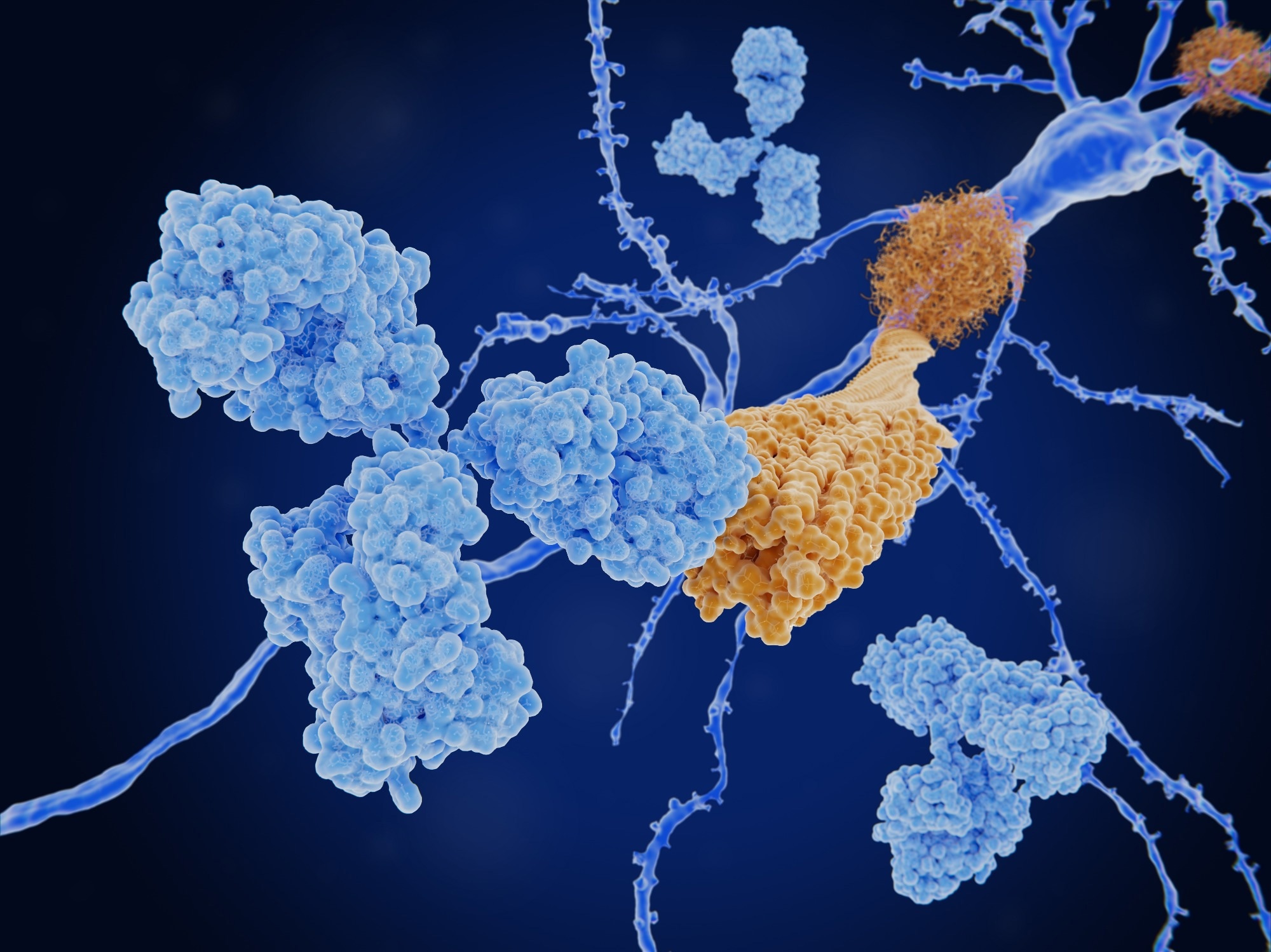Perspective: Considering challenges for the new Alzheimer