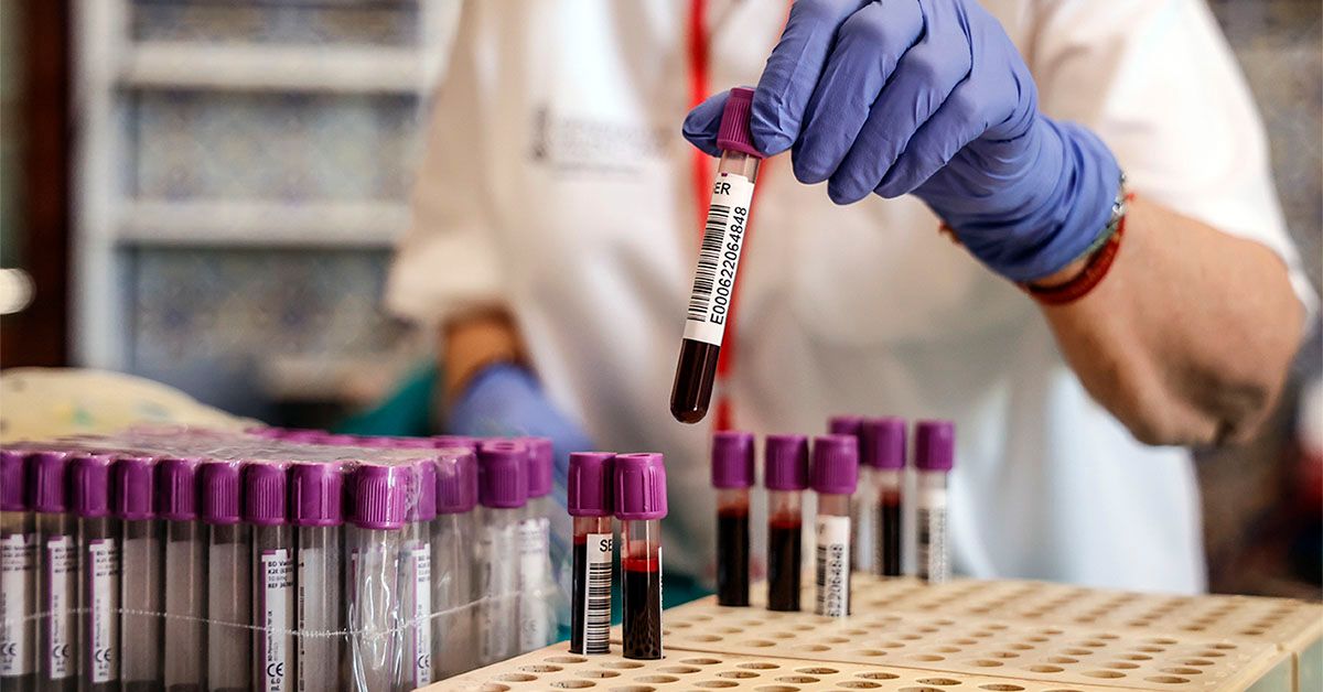 Un test sanguin montre une précision de 90 % dans l'identification de ...