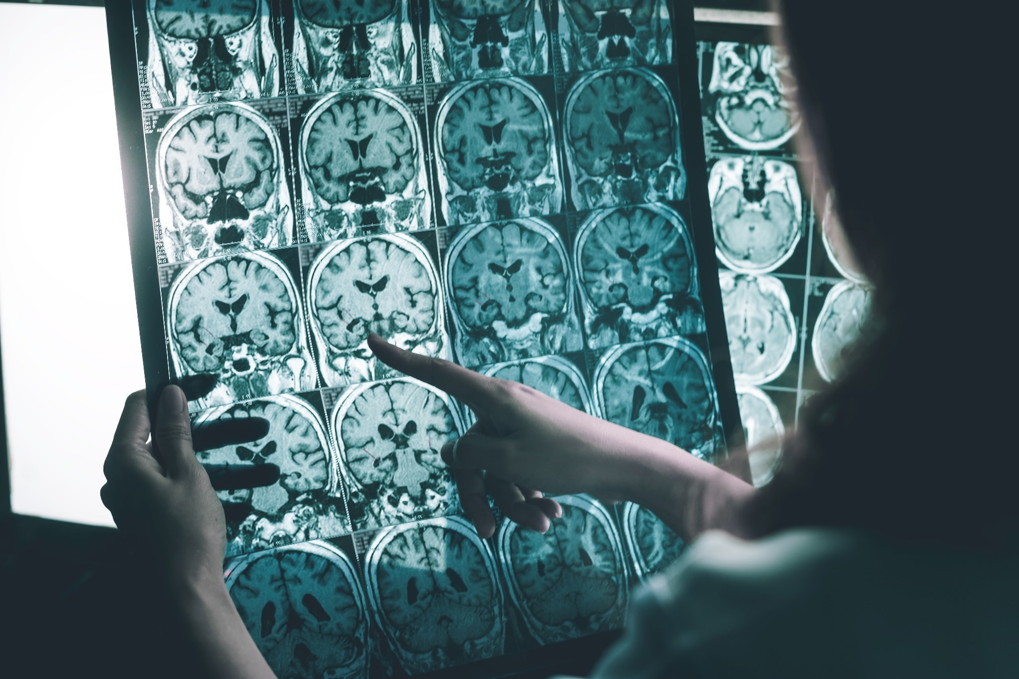 Resource: Single-nucleus transcriptomic profiling of human orbitofrontal cortex reveals convergent effects of aging and psychiatric disease. Image Credit: Atthapon Raksthaput / Shutterstock
