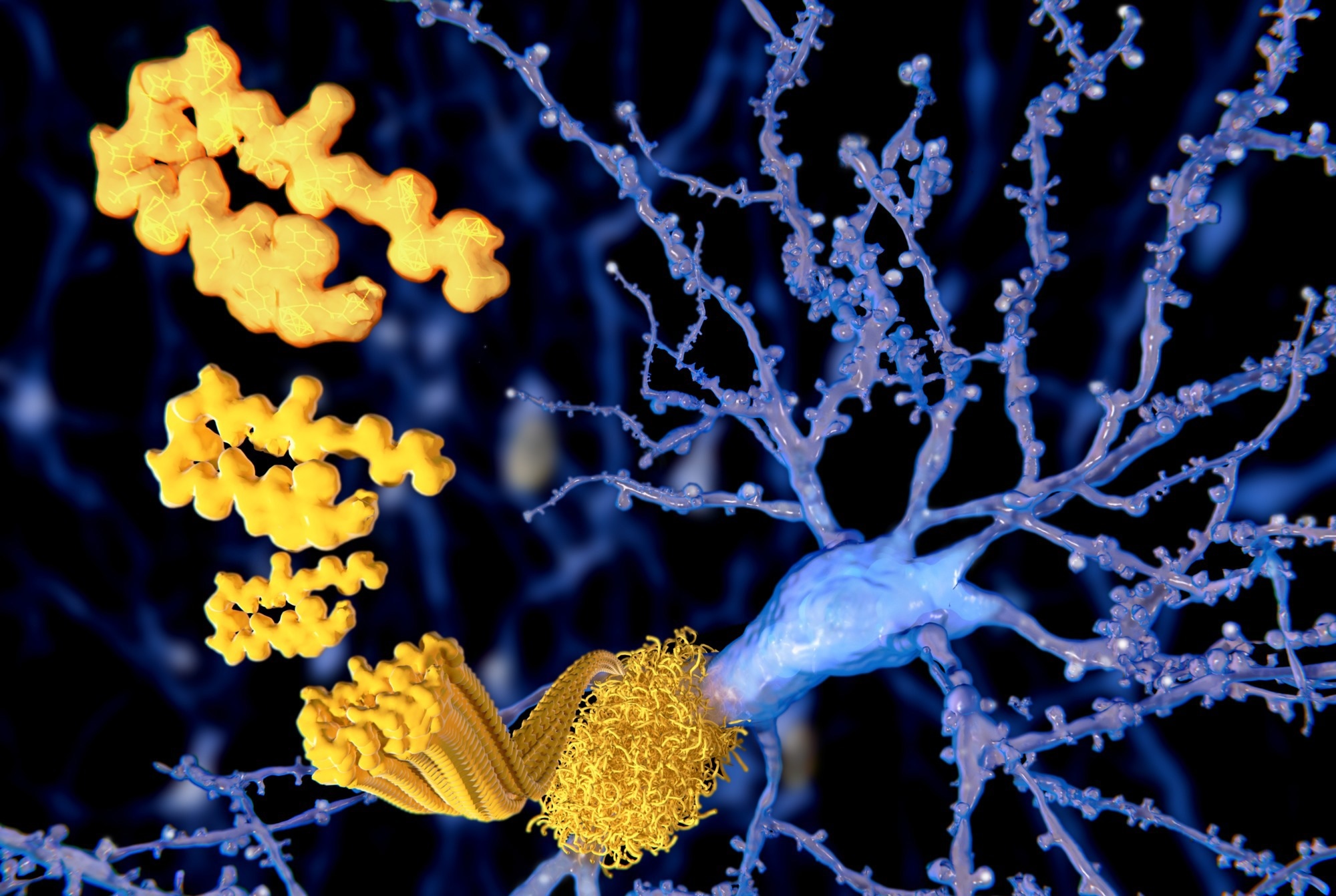 Study: Synergistic association of Aβ and tau pathology with cortical neurophysiology and cognitive decline in asymptomatic older adults. Image Credit: Juan Gaertner / Shutterstock