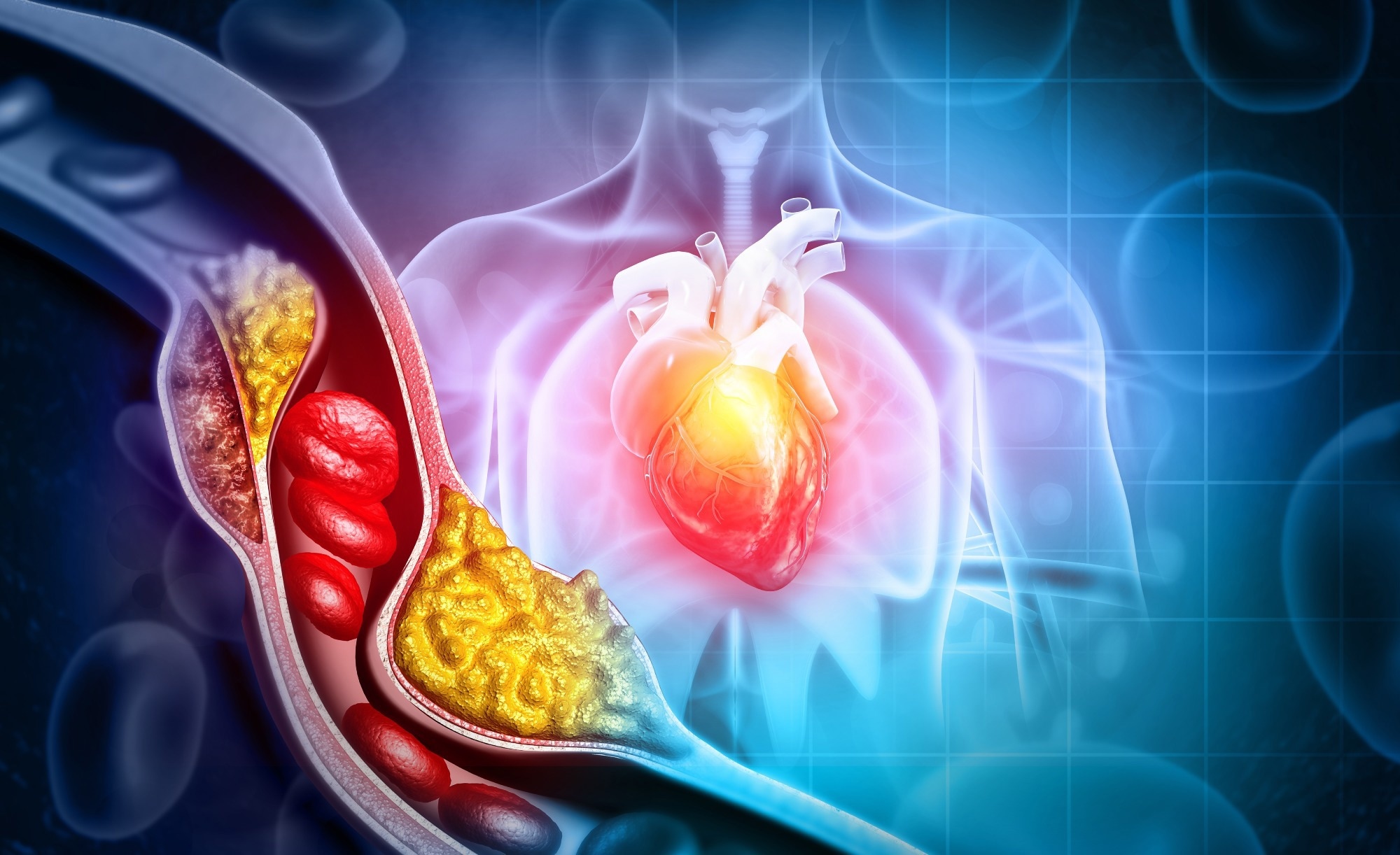 Study: Early intermittent hyperlipidaemia alters tissue macrophages to fuel atherosclerosis. Image Credit: crystal light / Shutterstock