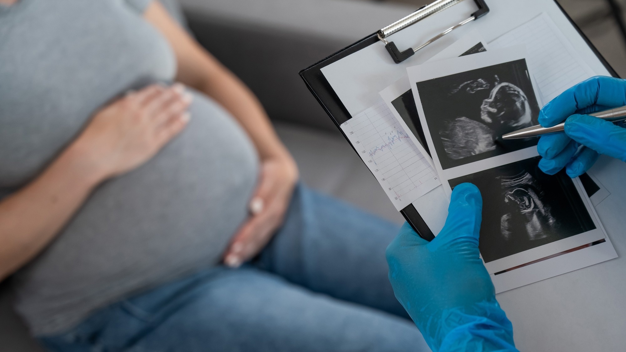 L’obésité maternelle double le risque de développer l’autisme chez l’enfant
