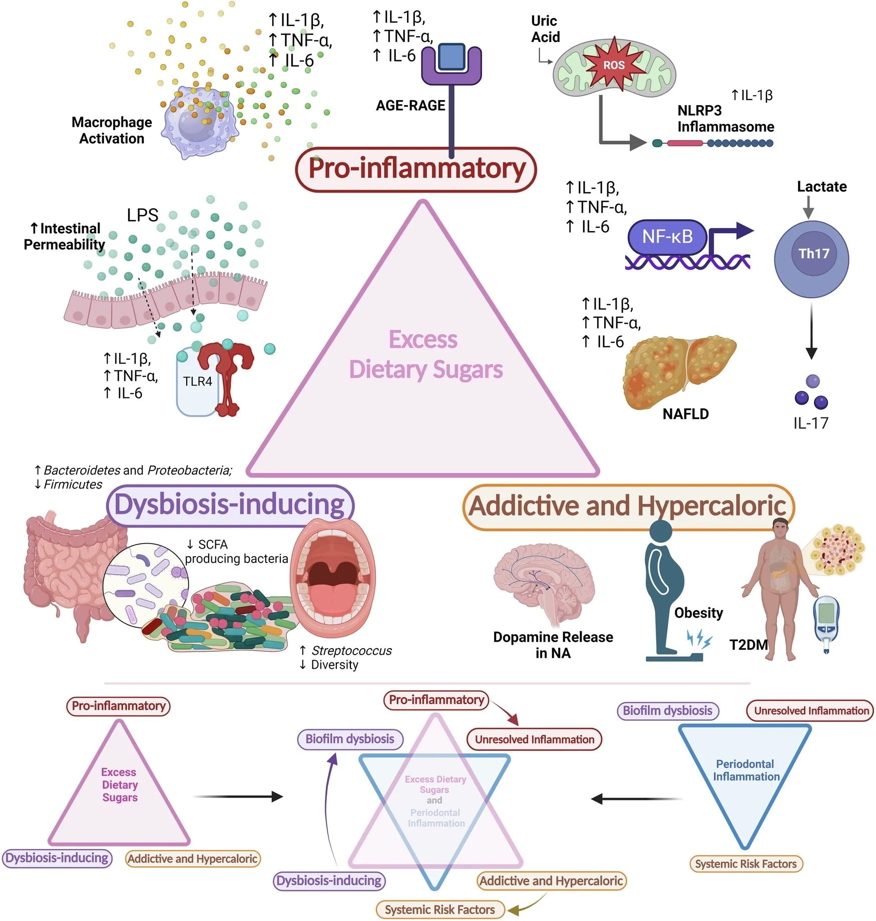Une consommation excessive de sucre déclenche une inflammation et une dysbiose, aggravant la maladie parodontale