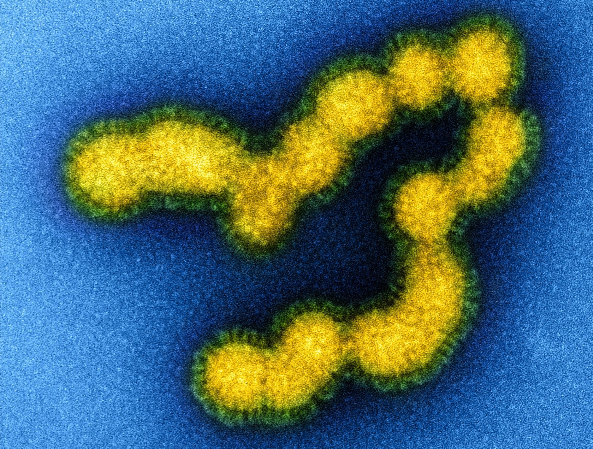 Study: Antiviral Susceptibility of Swine-Origin Influenza A Viruses Isolated from Humans, United States. Image Credit: NIAID