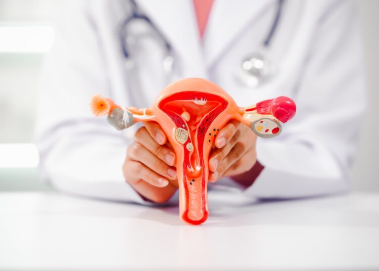 Study: Gut microbiota in women with polycystic ovary syndrome: an individual based analysis of publicly available data. Image Credit: NTshutterth/Shutterstock.com