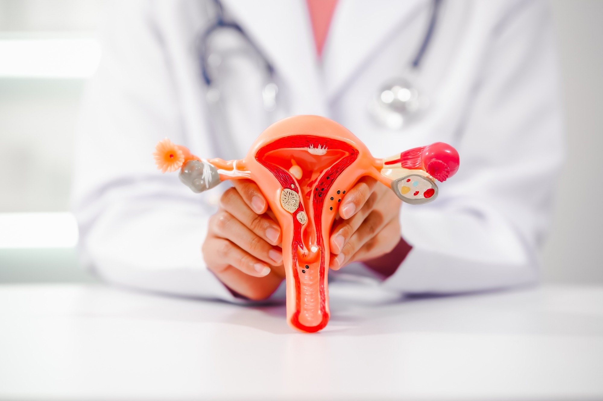 Study: Gut microbiota in women with polycystic ovary syndrome: an individual based analysis of publicly available data. Image Credit: NTshutterth/Shutterstock.com