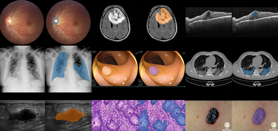Medical Images