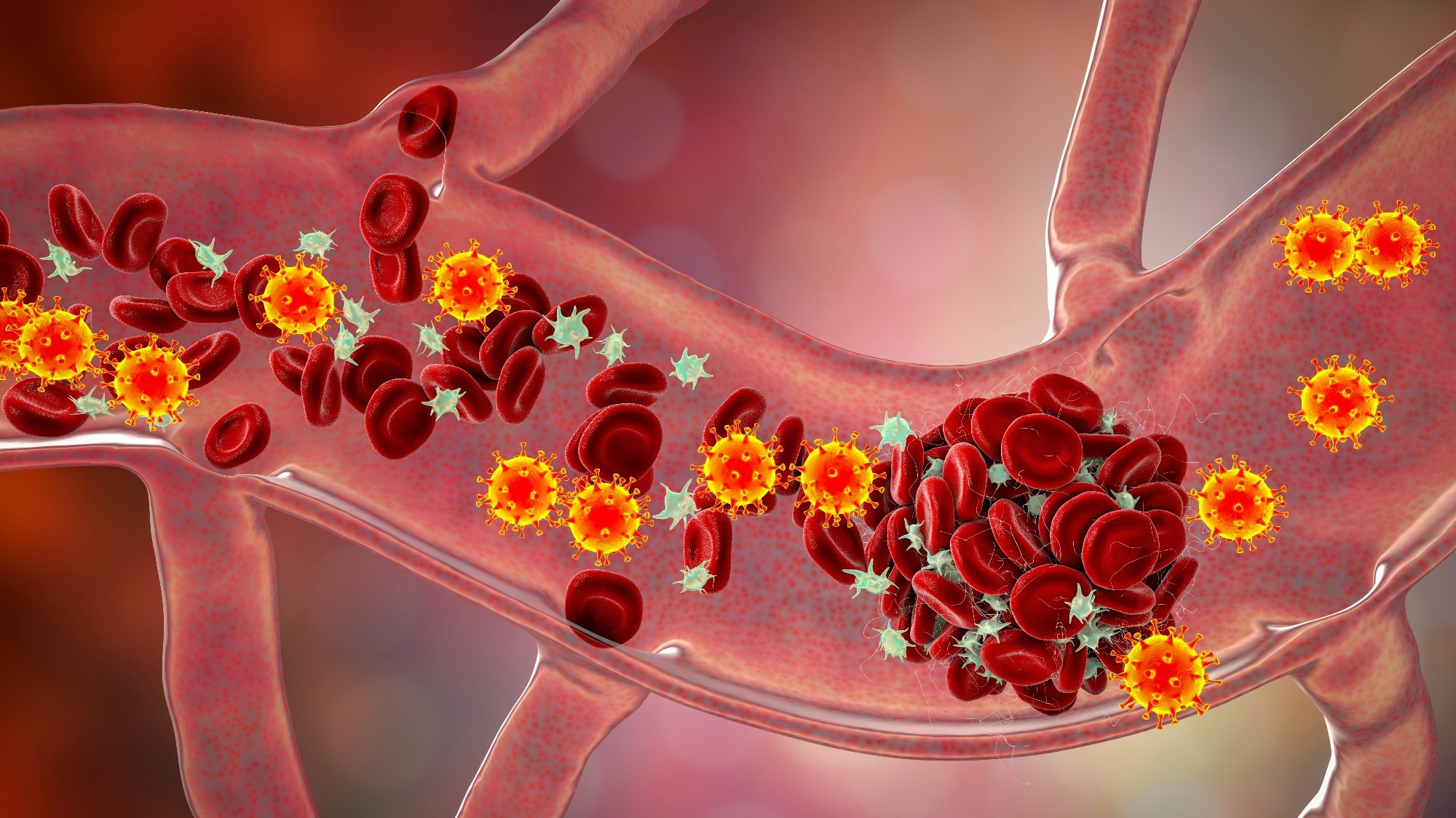 Le SRAS-CoV-2 détourne le trafic du cholestérol pour alimenter l’infection et échapper aux réponses immunitaires