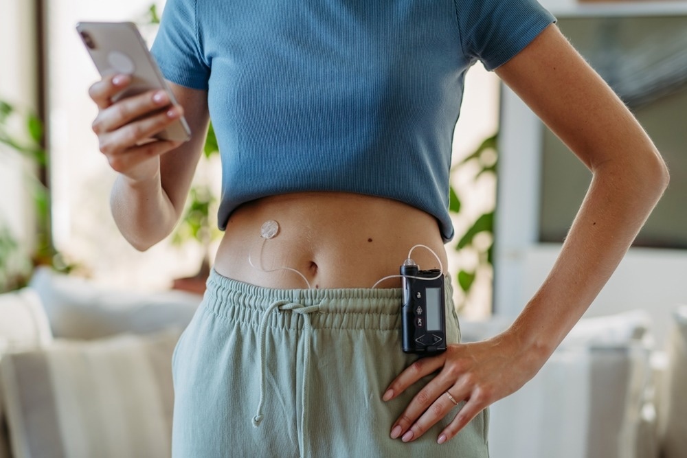 Study: Younger-onset compared with later-onset type 2 diabetes: an analysis of the UK Prospective Diabetes Study (UKPDS) with up to 30 years of follow-up (UKPDS 92). Image Credit: Halfpoint/Shutterstock.com