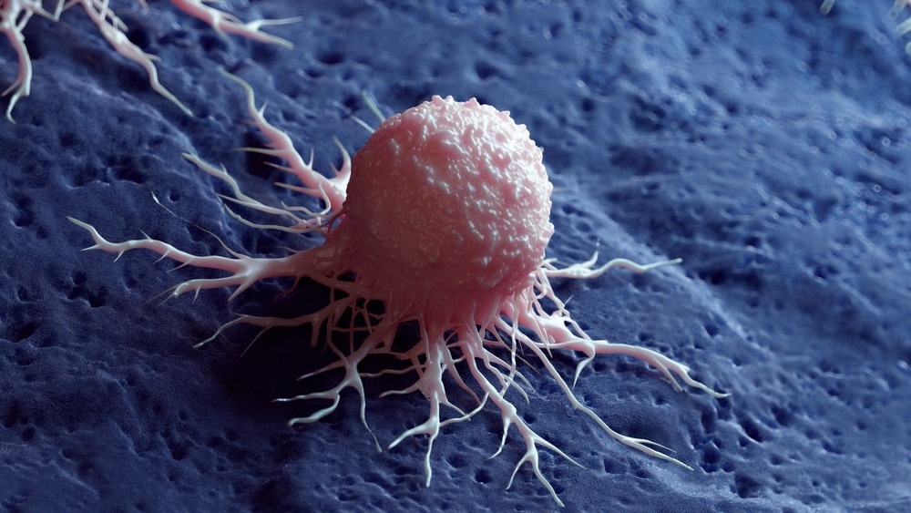 Study: Itaconate transporter SLC13A3 impairs tumor immunity via endowing ferroptosis resistance. Image Credit: Sebastian Kaulitzki/Shutterstock.com