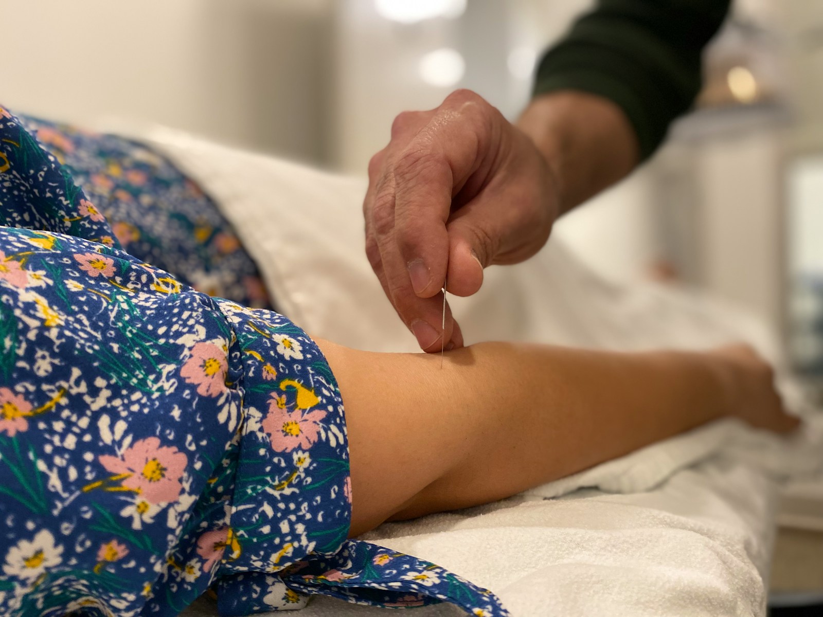 L'acupuncture pour arrêter de fumer : est-ce que ça marche ?