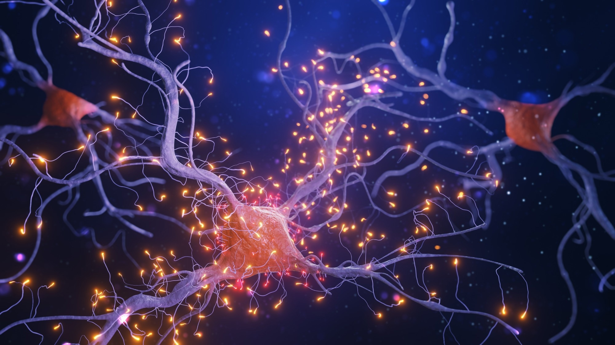 La connectivité neuronale prédit le succès de la stimulation cérébrale profonde dans les tremblements essentiels