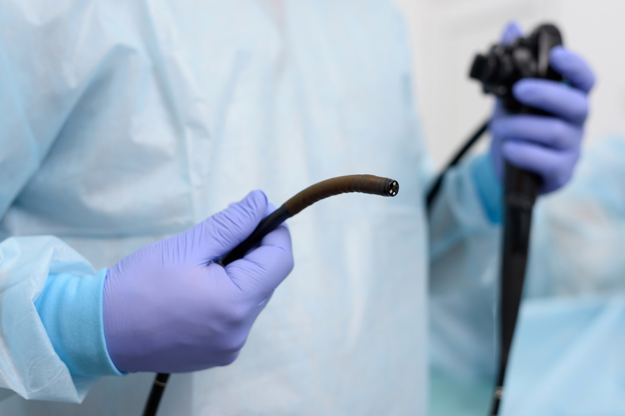 Le test à l’éponge-capsule révolutionne le diagnostic du RGO et réduit les endoscopies inutiles