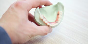 Réhabilitation totale des dents : étapes, prix et solutions dentaires