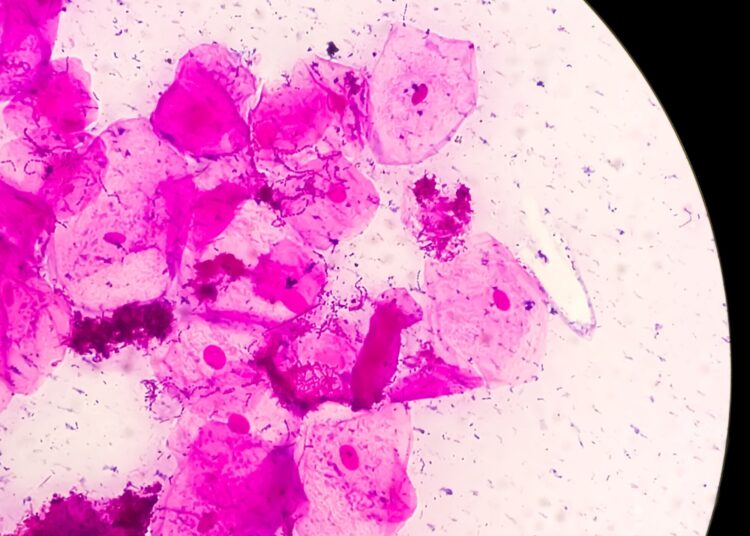Microscopic close view of high vaginal swab Gram stain smear, 40x.