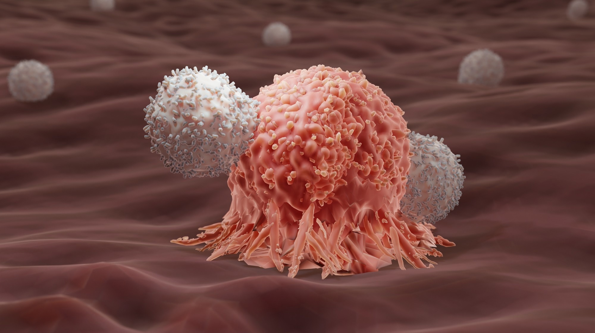 La thérapie CAR-T définit une nouvelle étape dans le traitement du neuroblastome