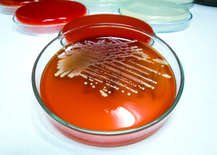Staphylococcus aureus: Gram-positive, to Gram-variable, nonmotile, Coccus, beta hemolysis, saprotrophic bacterium.