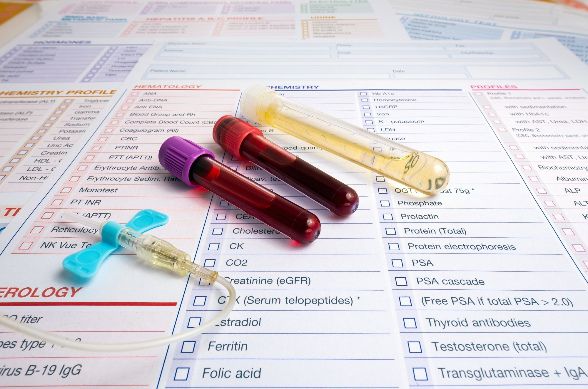 Blood tubes and urine of patient with test report for analysis in the Hematology lab.