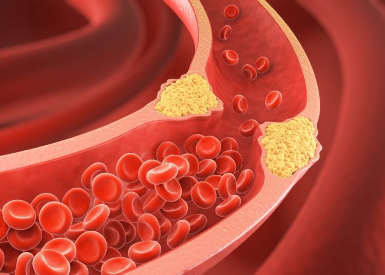 Study: A potent epigenetic editor targeting human PCSK9 for durable reduction of low-density lipoprotein cholesterol levels. Image Credit: Anusorn Nakdee / Shutterstock