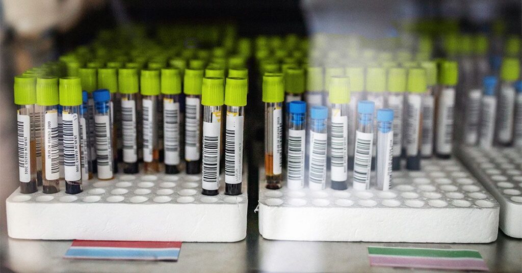Un nouveau test peut prédire quels patients atteints de MII présentent un risque de cancer colorectal plus élevé