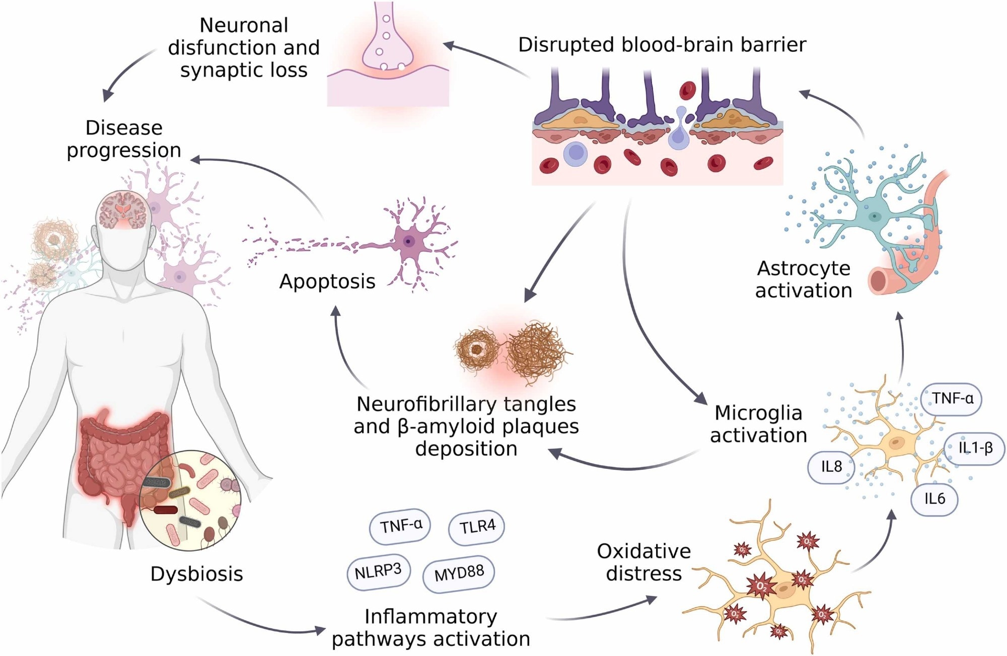 Cette figure illustre le rôle de la dysbiose intestinale dans la neuroinflammation et la physiopathologie d'Alzheimer