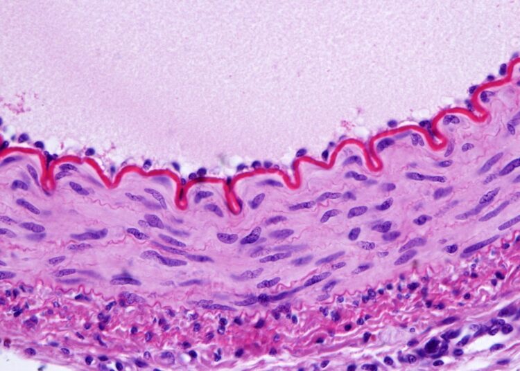 Cross-sectioned muscular artery