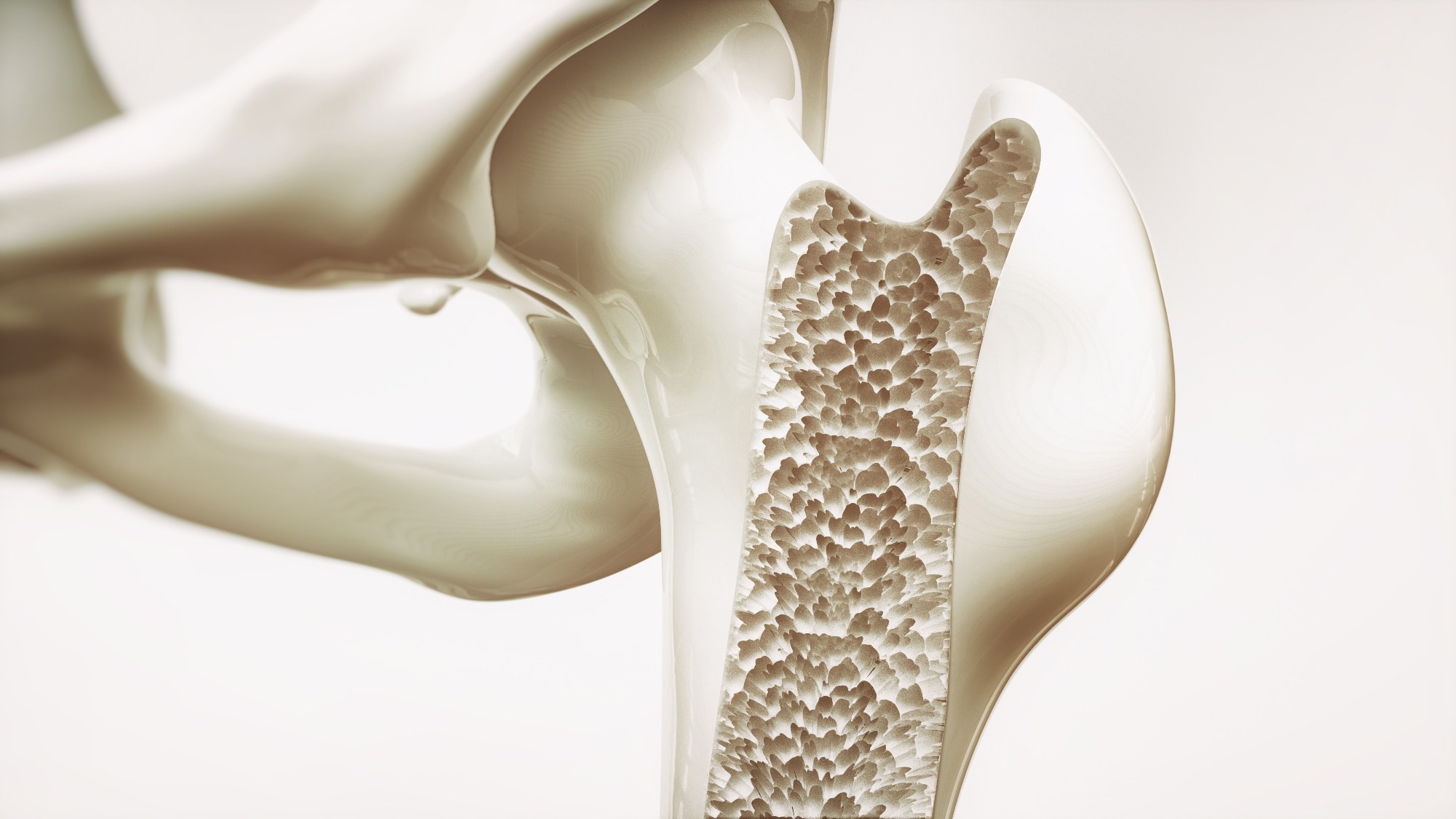 Review: The Impact of Fermented Dairy Products and Probiotics on Bone Health Improvement. Image Credit: Crevis / Shutterstock
