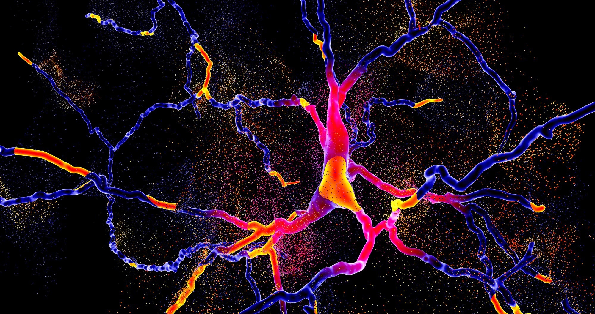 Study: Pre-symptomatic Parkinson’s disease blood test quantifying repetitive sequence motifs in transfer RNA fragments. Image Credit: Kateryna Kon / Shutterstock