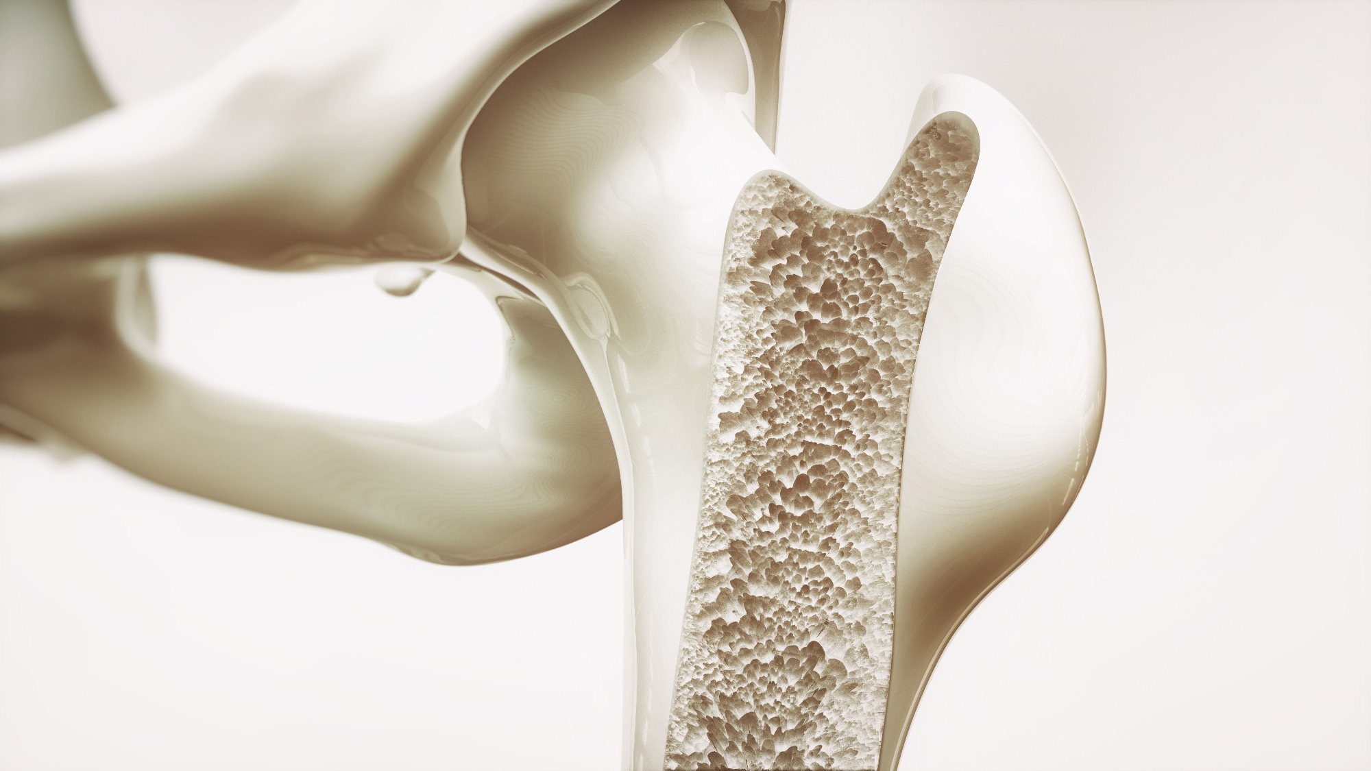 Study: The association between lipid accumulation products and bone mineral density in U.S. Adults, a nationally representative cross-sectional study. Image Credit: Crevis / Shutterstock