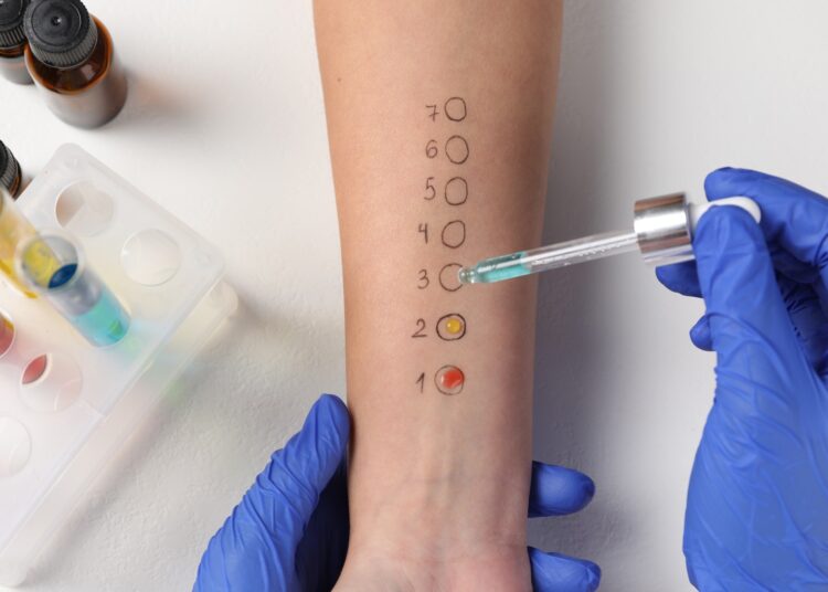 Doctor doing skin allergy test at light table, top view