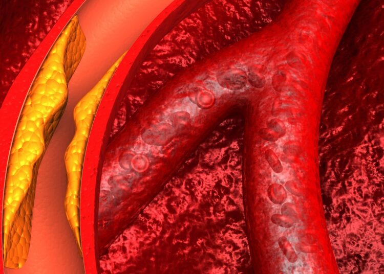 Study: Safety and Efficacy of Obicetrapib in Patients at High Cardiovascular Risk. Image Credit: Explode / Shutterstock