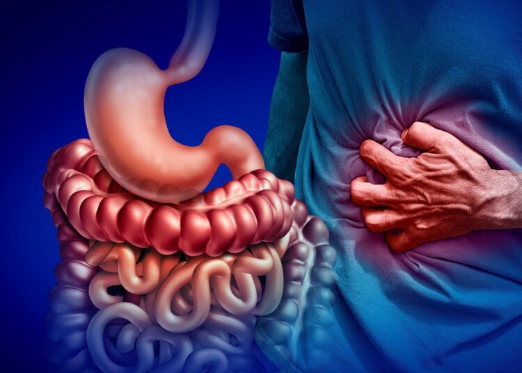 Study: The effect of low-FODMAP diet on patients with irritable bowel syndrome. Image Credit: Lightspring / Shutterstock