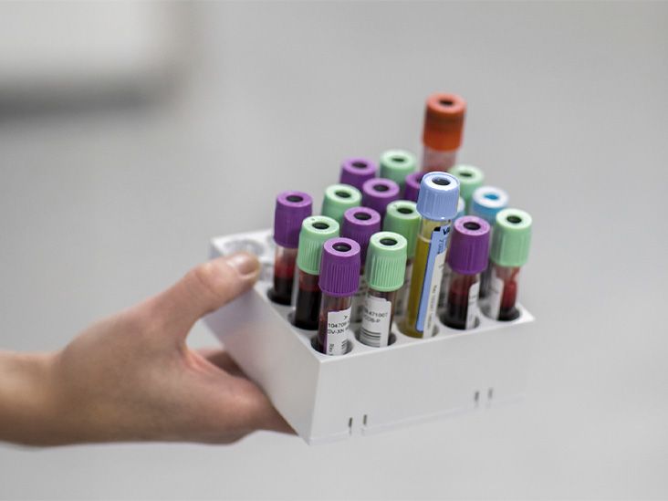 Premier test sanguin pour Alzheimer obtient la FDA Greenlight: 3 choses à savoir