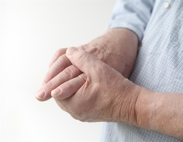 De nouvelles perspectives sur les stratégies de gestion de la goutte et les résultats cardiovasculaires