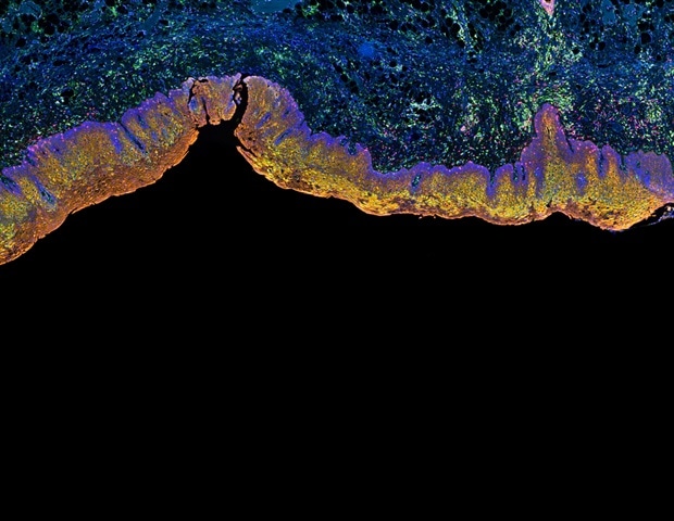 La nouvelle méthode d'immunohistochimie 3D améliore l'imagerie des tissus profonds