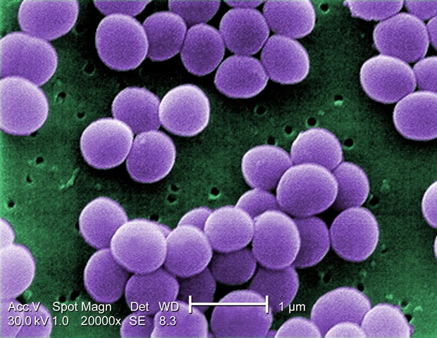 La nouvelle plate-forme de nanoparticules se brise à travers les biofilms SARM