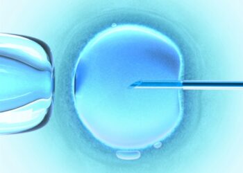 Microbiote intestinal et changements métaboliques liés aux risques de grossesse chez les femmes atteintes de SOPK