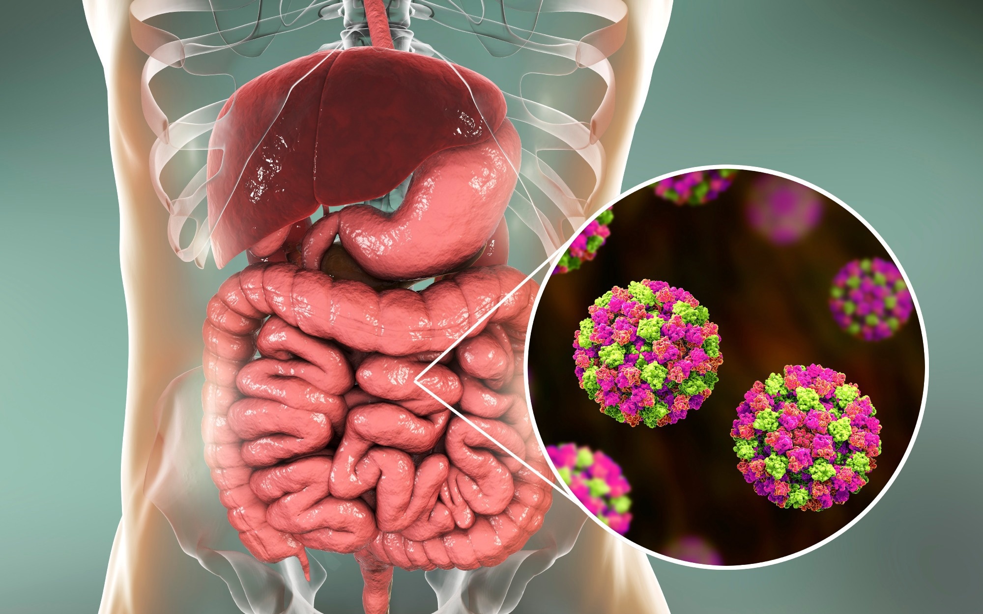 Research: Increasing Predominance of Norovirus GII.17 over GII.4, United States, 2022–2025. Image Credit: Kateryna Kon / Shutterstock