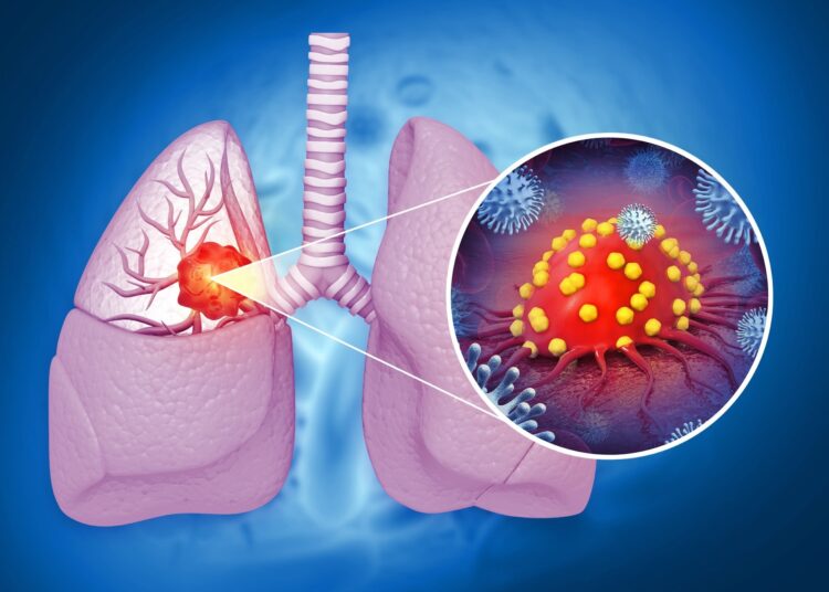 Review: Correlation between allergic diseases and lung cancer: a systematic review and meta-analysis. Image Credit: crystal light  / Shutterstock