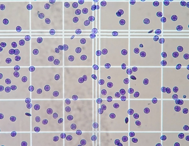 Denovix libère de nouvelles applications FLXI CellDrop