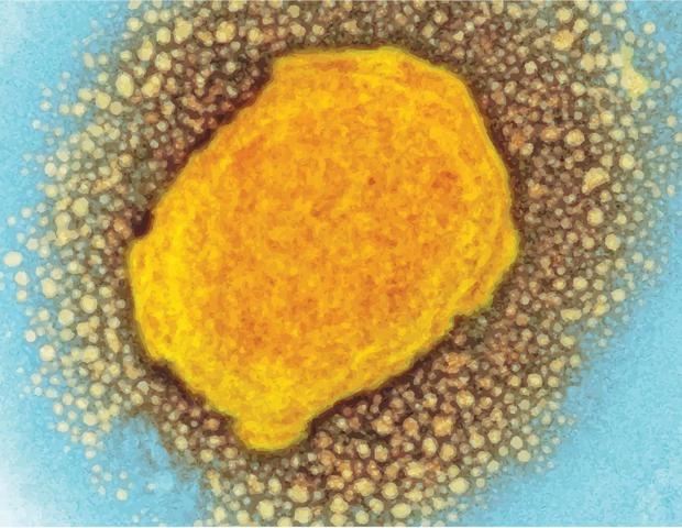 La charge virale sanguine prédit la gravité des symptômes MPOX