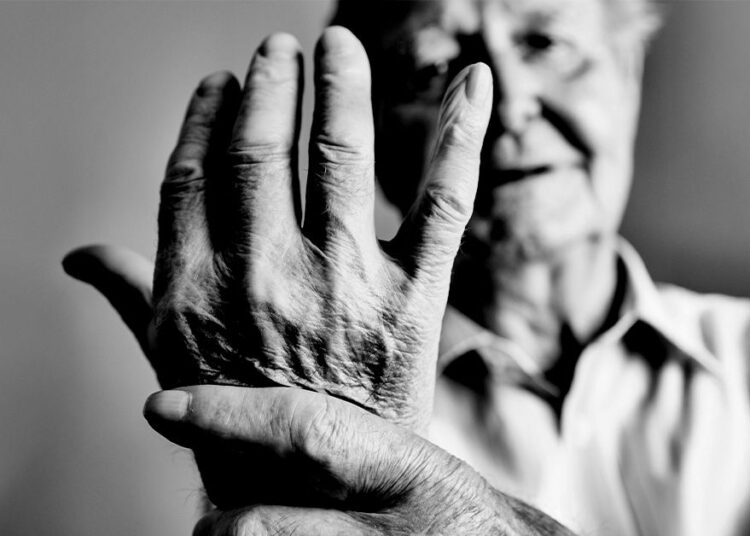 Le test clinique peut prédire la meilleure polyarthrite rhumatoïde biologique pour chaque individu