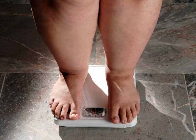 Study: Energy expenditure and obesity across the economic spectrum. Image Credit: Valente Romero / Shutterstock
