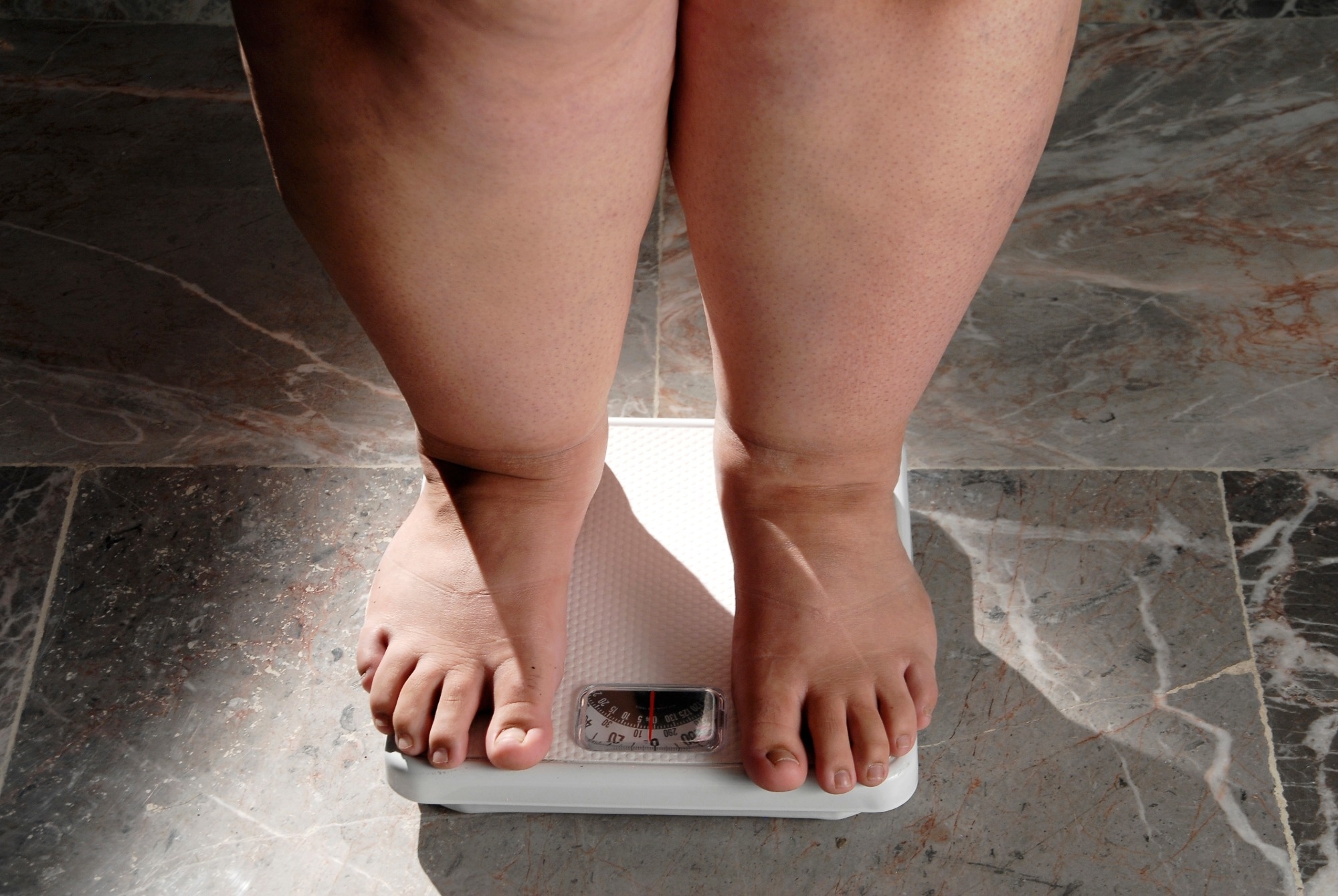 Study: Energy expenditure and obesity across the economic spectrum. Image Credit: Valente Romero / Shutterstock